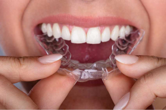 Want Straighter Teeth? Let's Talk Clears Aligners
