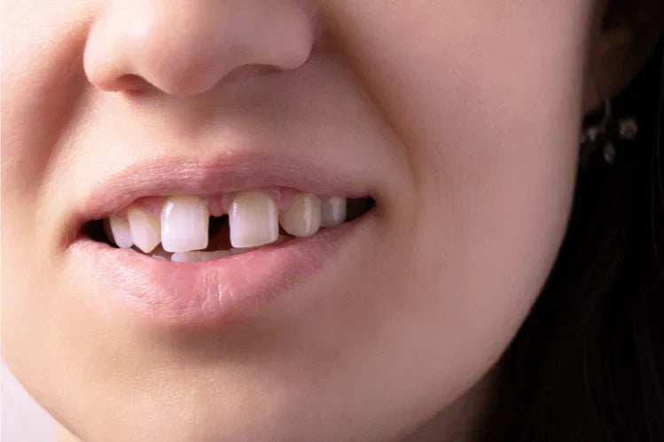 A girl is showing her front gap teeth