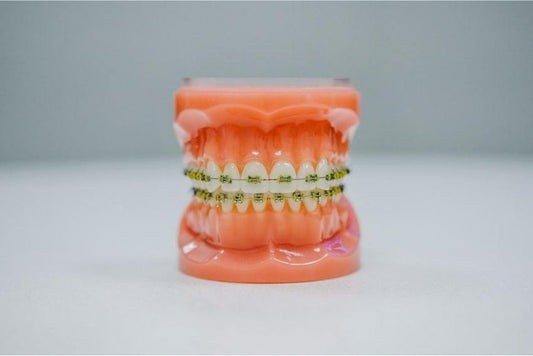 How Long Do Braces Hurt After Getting Them On?