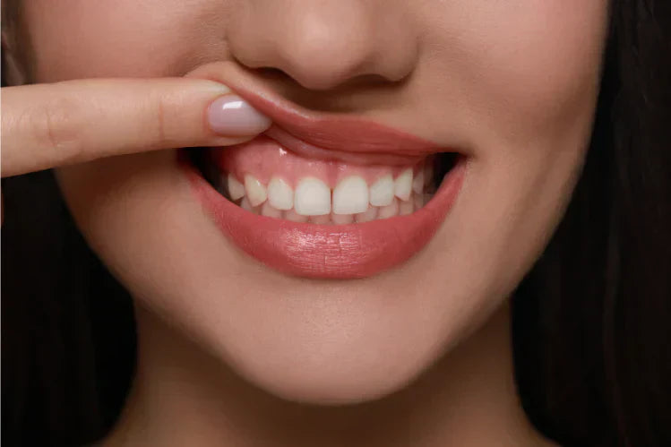 A young woman showing buck teeth (Overbite)