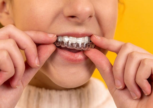 Quicker Than Braces - Clear Aligners From AlignerCo