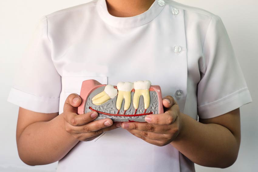 Why Do We Have Wisdom Teeth & Can You Keep Them If Not Problematic?