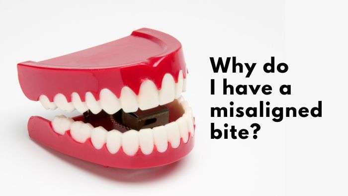 Why do I have a misaligned bite?