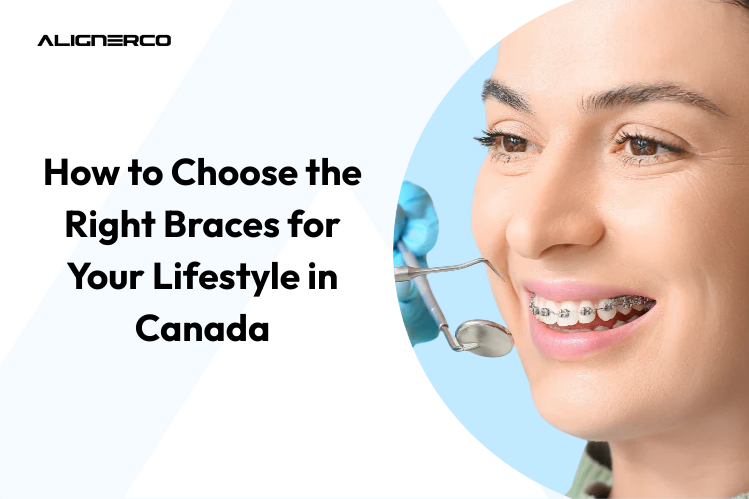 How to Choose the Right Braces for Your Lifestyle in Canada