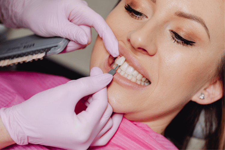 Clear Aligners Vs Veneers