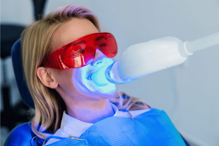 Teeth Whitening