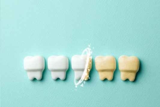 Before and after teeth whitening results