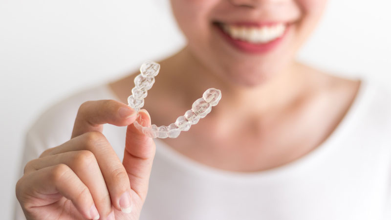 Teeth Straightening Without Braces: What Are My Options