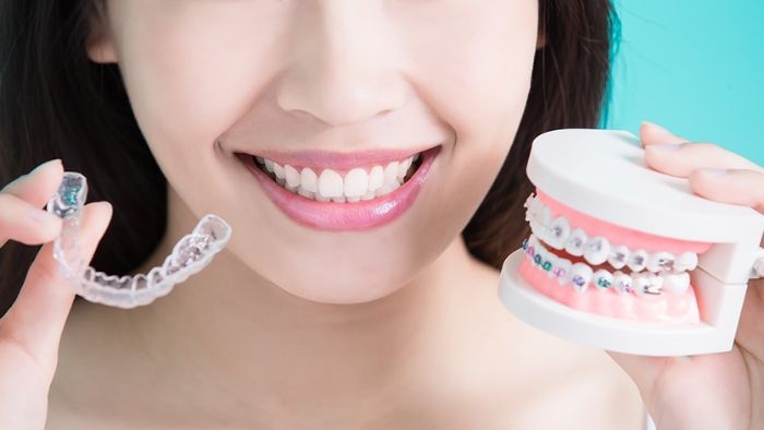 wish had braces as a kid, but hesitant to get Adult Braces