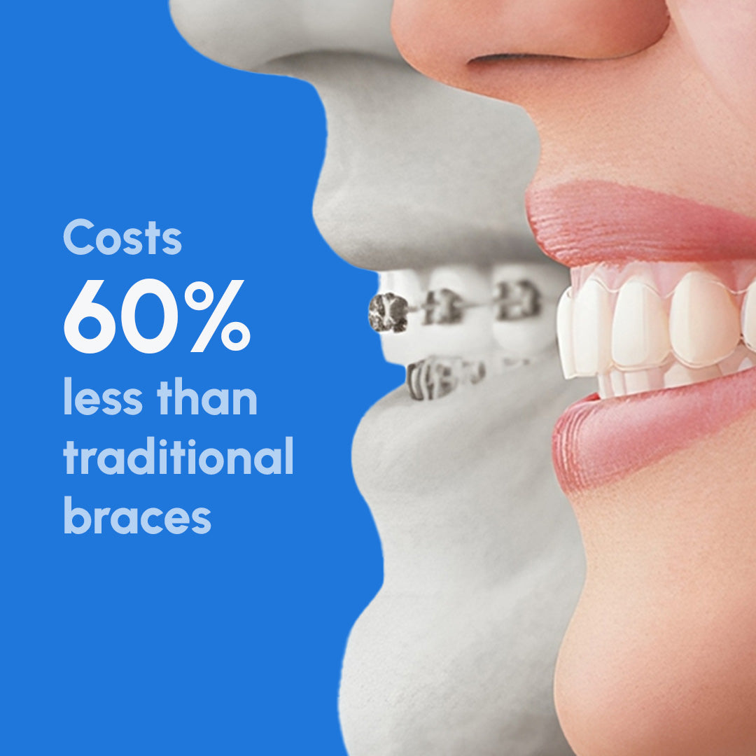 Smiling face with clear aligners next to grayscale braces comparison