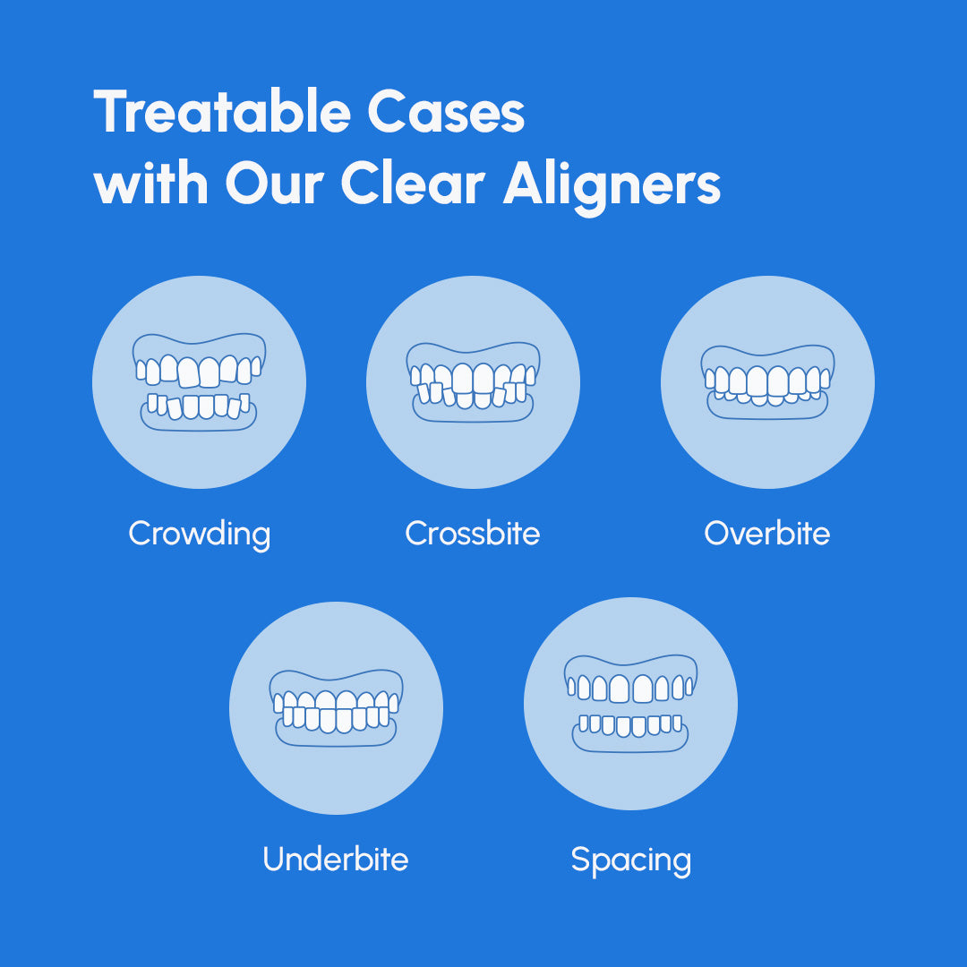Common dental misalignments treated with ALIGNERCO clear aligners