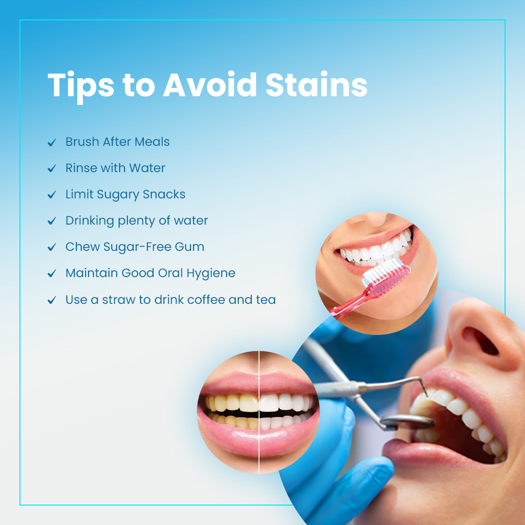 Tips to avoid teeth stains with oral hygiene checklist and whitening visuals