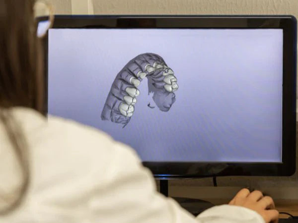 Orthodontist viewing 3D dental scan on a computer screen for treatment planning.