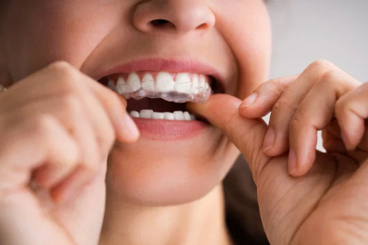 aligners.