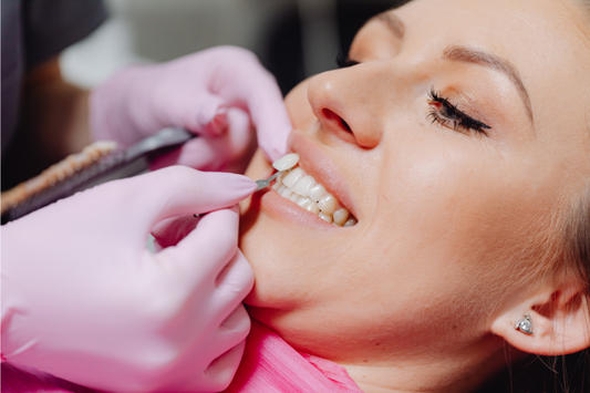 A dentist applying a veneer to a tooth on a patient