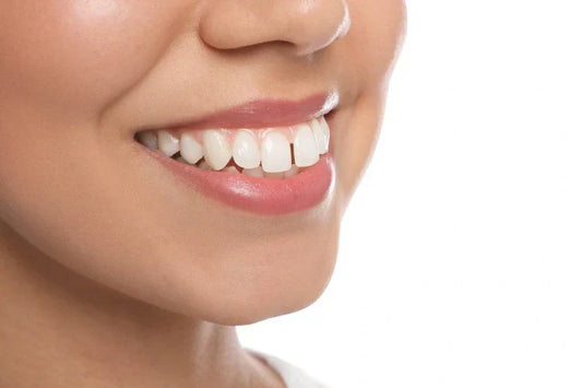 gapped teeth