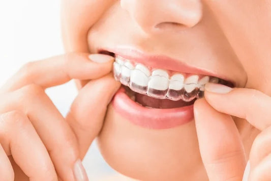 image of a girl putting on clear aligners.