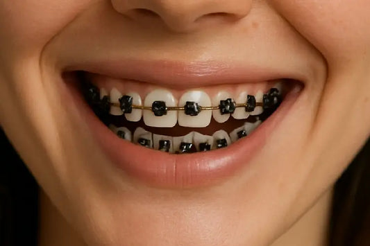 A girl smiling with black braces on her teeth