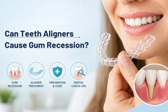 Can Teeth Aligners Cause Gum Recession? A Comprehensive Look