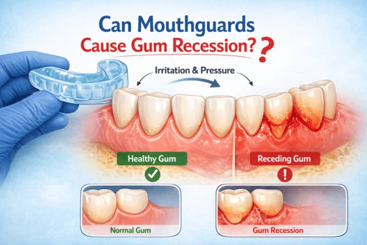 A graphic representation of gum recession due to mouthguards