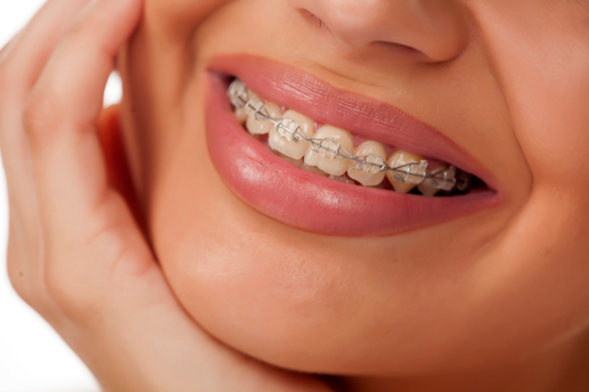 A girl is wearing clear braces