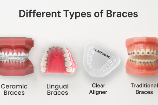 Different styles of braces for teeth straightening.