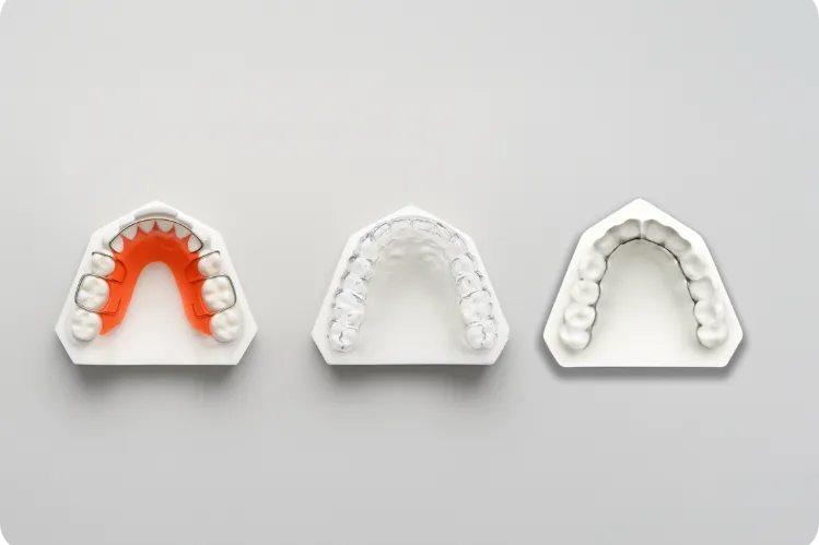  Illustration of different types of retainers.  