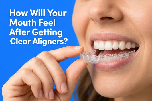 Close-up of a hand inserting a clear aligner tray onto the upper teeth.