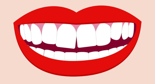 Lower teeth perfect but upper teeth might need some fixing