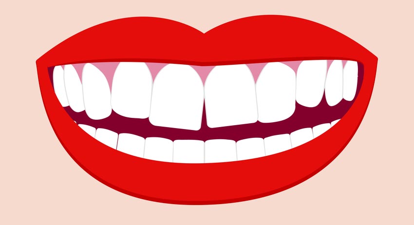 Lower teeth perfect but upper teeth might need some fixing