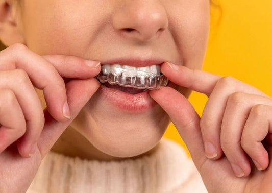 Metal vs. Ceramic Braces