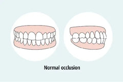 Dental Occlusion and Your Health: What You Need to Know