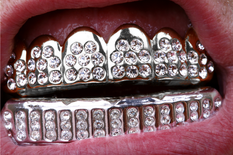 A close-up of teeth grillz.