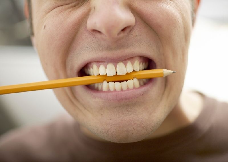 Underbite: Can You Fix it Without Surgery