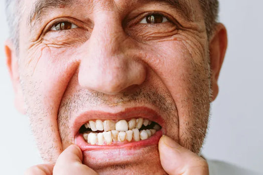 Ways Your Smile Changes As You Age