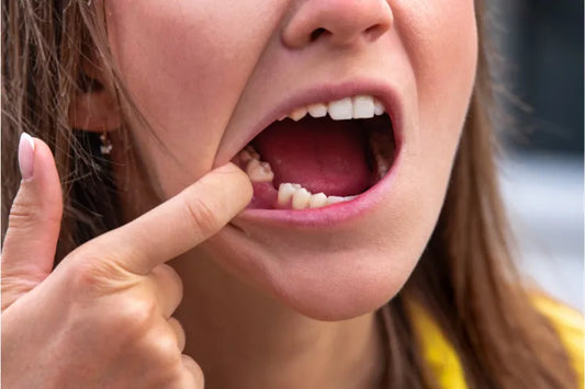What to Do if You Lose a Tooth as an Adult