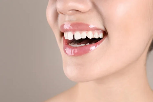 A woman smiling with a diastema in her teeth