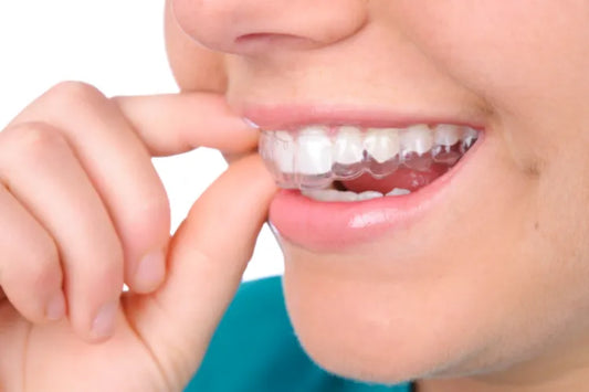 A close-up of a boy applying orthodontic retainers.