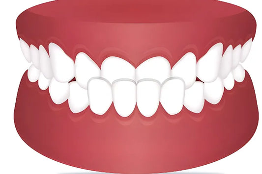 An illustration of a crossbite on a white background 
