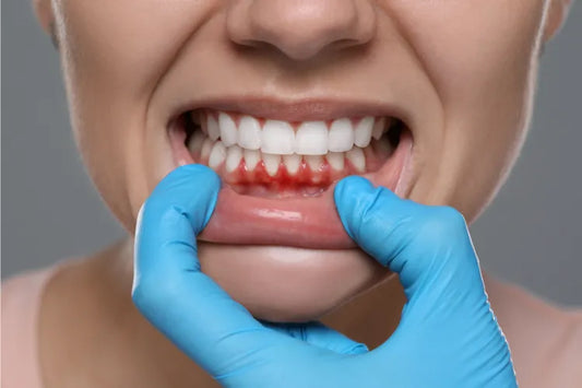 An image shows bleeding gums