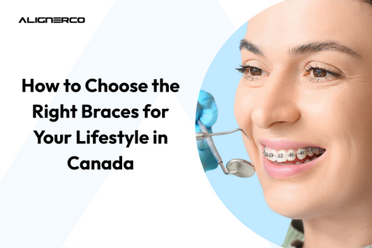 How to Choose the Right Braces for Your Lifestyle in Canada
