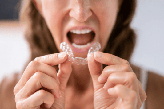 A Convenient Solution for Straightening Teeth