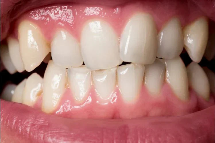 close-up image of uneven teeth