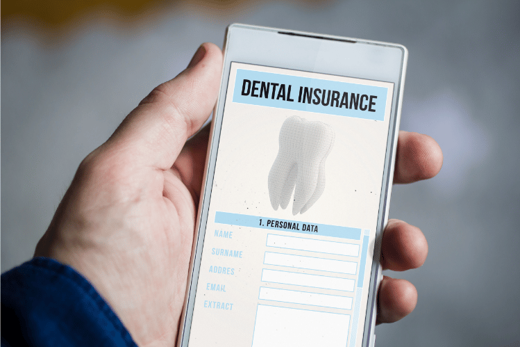 Clear aligners insurance