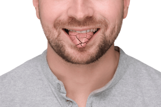 Dry Mouth and Oral Health