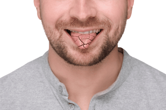 Dry Mouth and Oral Health