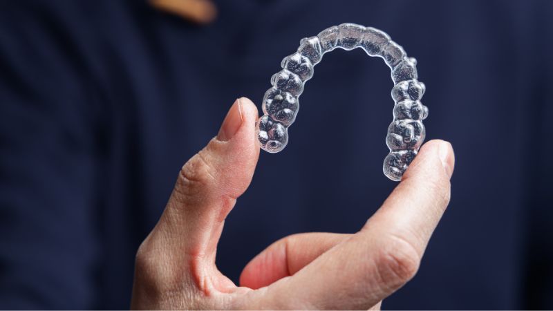 Invisible aligner cost in canada