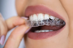 Retainers vs. Night Guards: Which is Better for TMJ?