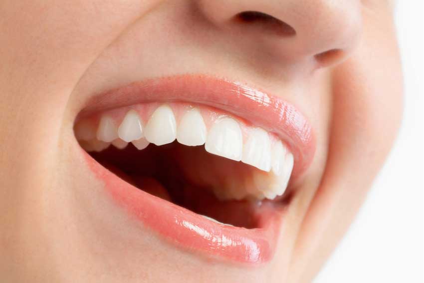 Oral Health Challenges