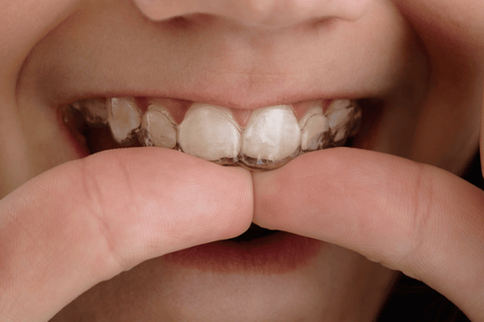 Retainer for teeth straightening